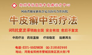 银屑病预防与治疗指南 如何选择专业医院？