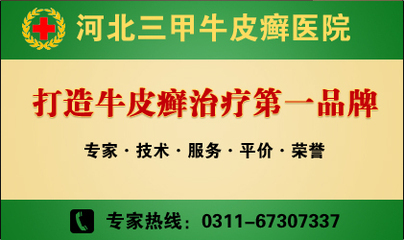 如何有效预防牛皮癣（银屑病）的发生？
